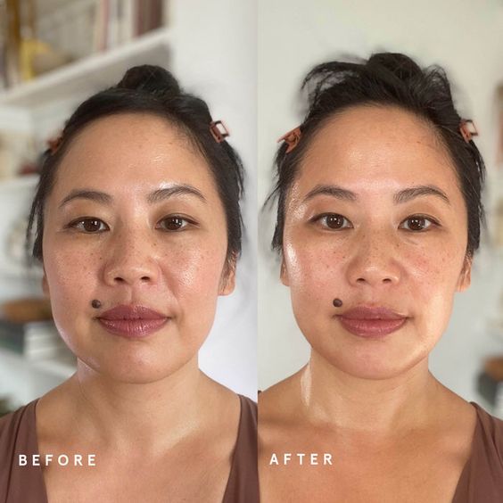 Gua Sha For Face Slimming Before and After