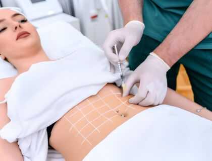 Mesotherapy For Weight Loss Guide