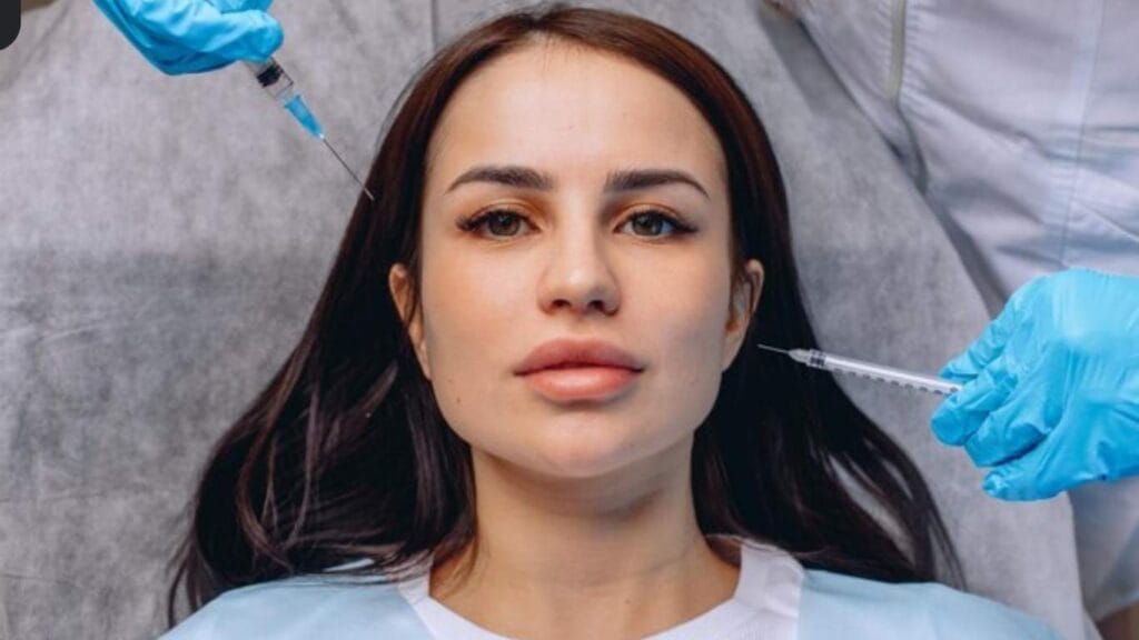 2ml Cheek Filler Before and After
