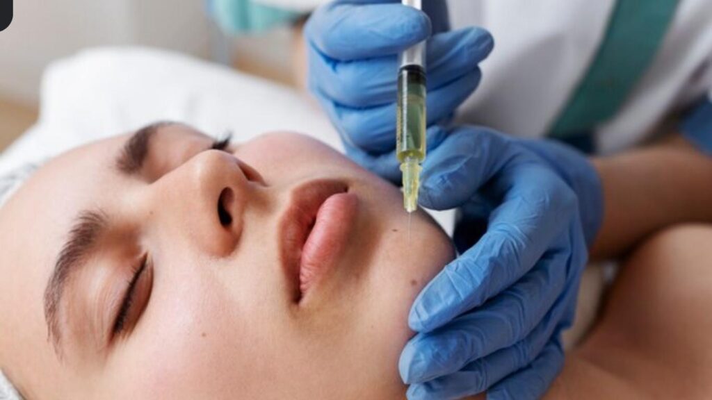 5 ml Lip Filler